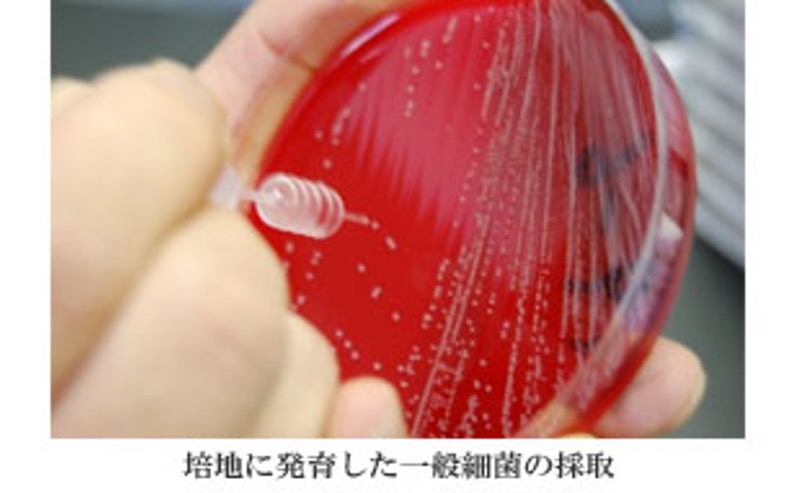抗酸菌の培養装置と遺伝子検査機器