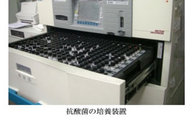 喀痰の鏡検像(白血球と肺炎球菌)と培地に発育した一般細菌の採取